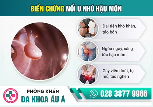 U NHÚ HẬU MÔN